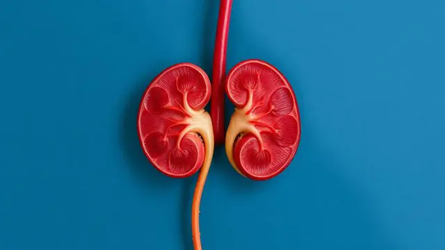 Gagal Ginjal Intai Anak Muda, Kenali 6 Cara Mencegahnya