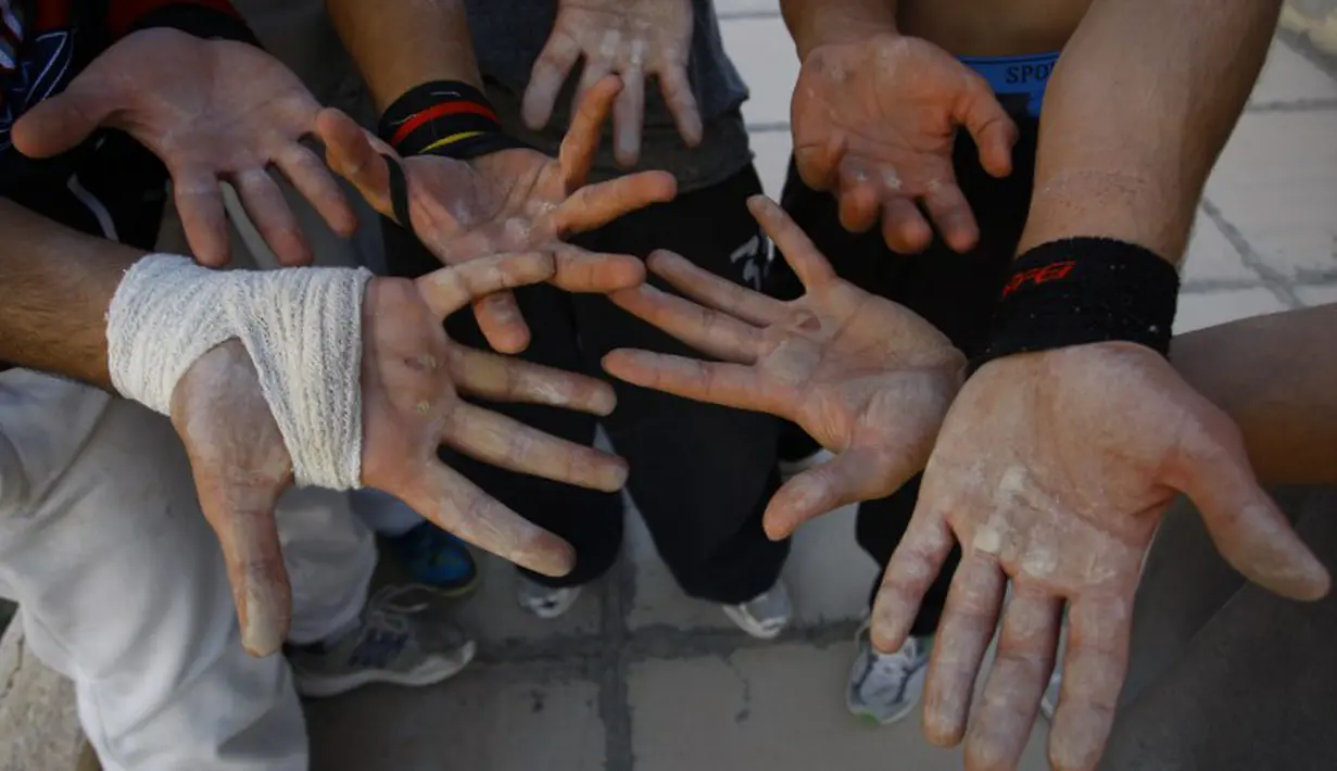  Para pemuda Irak ini menunjukkan tangannya yang penuh luka akibat dari latihan Parkour, Irak, Rabu (14/05/2014) (AFP PHOTO/HAIDER HAMDANI).