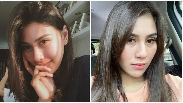 6 Perbedaan Wajah Syahnaz Sadiqah dari Sebelum Vs Setelah Dituding Oplas