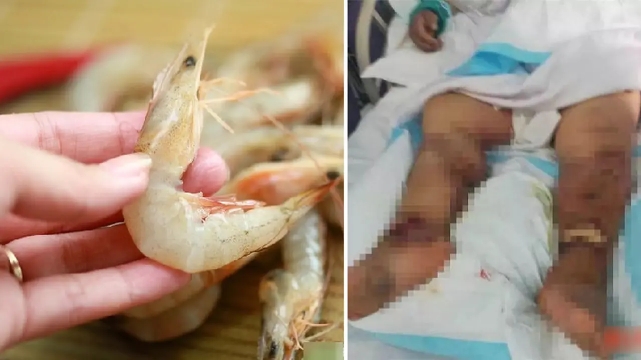 Ngeri, Wanita Ini Meninggal karena Terluka Membersihkan Udang
