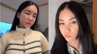 Pengakuan Maria Karina, istri Chef Wilgoz yang operasi plastik hingga ke Korea. (Dok: TikTok @mariakarinaa)