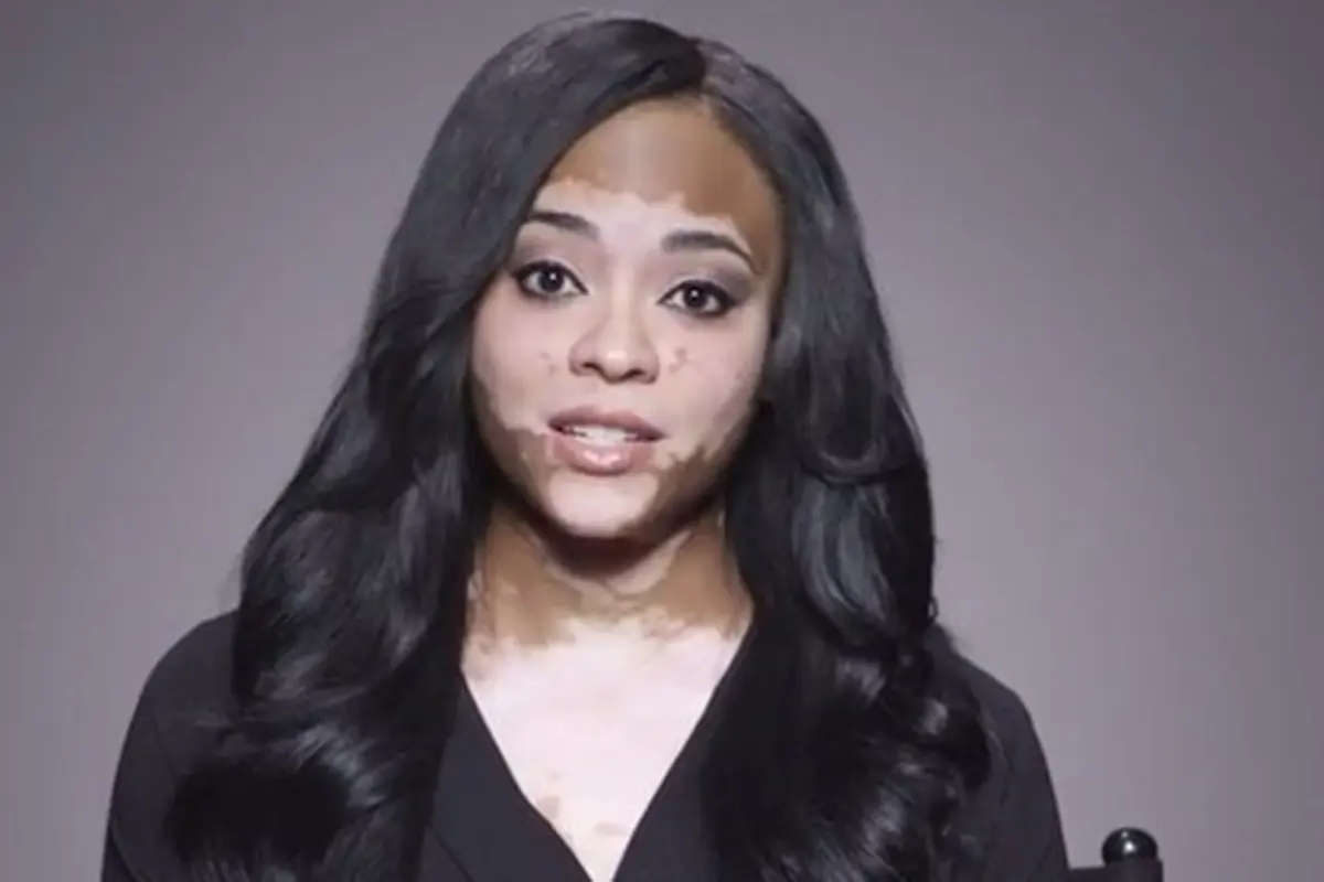 Photo copyright Youtube/Dermablend Professional