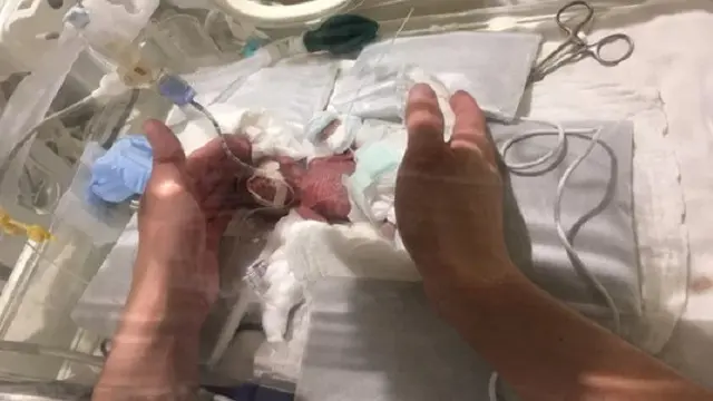 Bayi terkecil di dunia