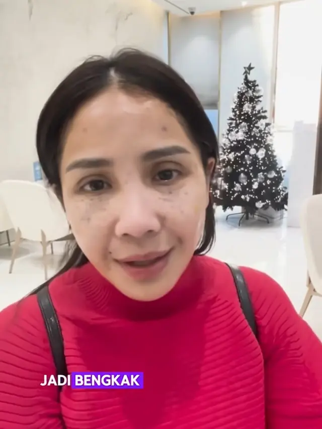 Nagita Slavina Perawatan
