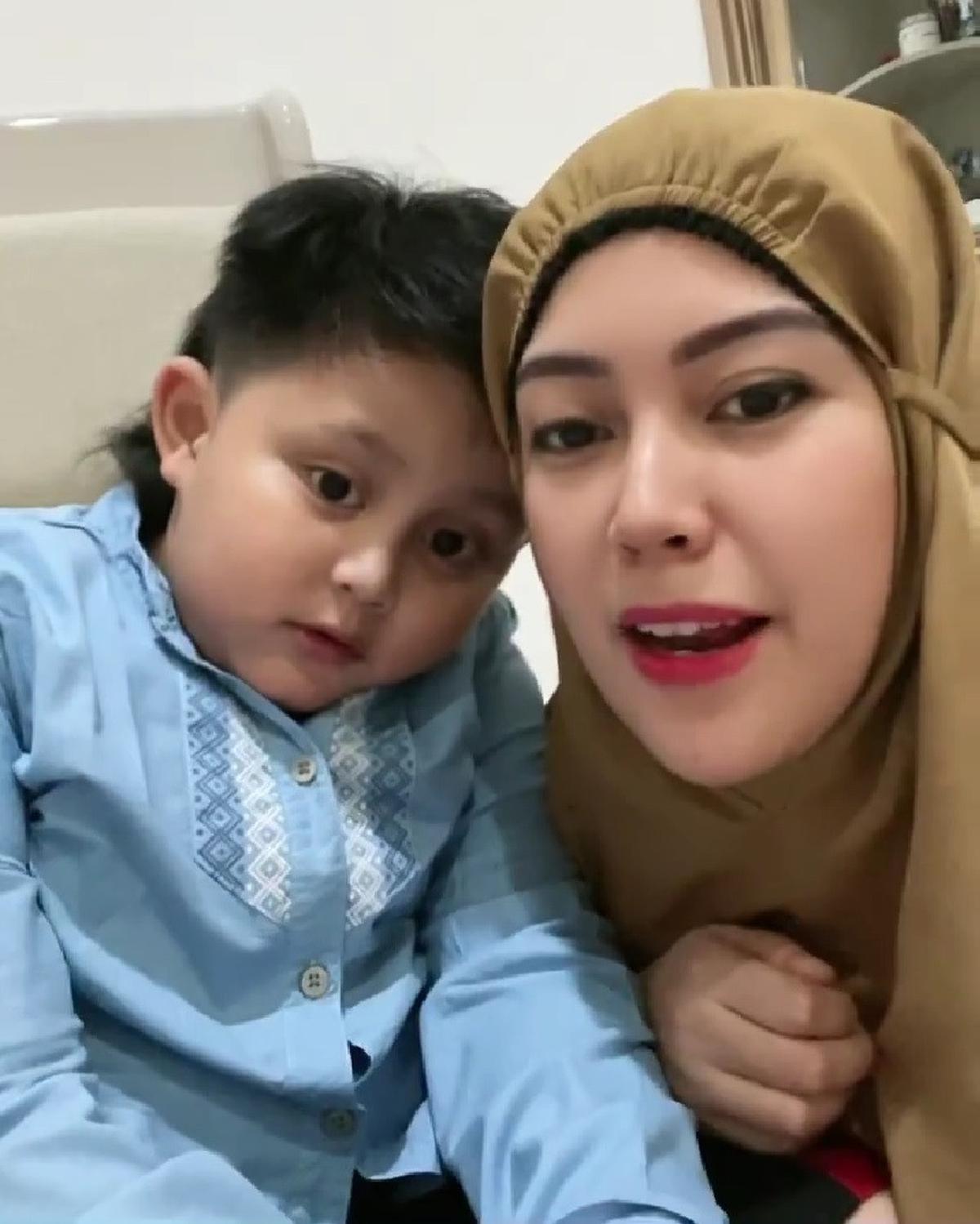 Yama Carlos Sebut Belum Dipertemukan dengan Anak, Arfita Dwi Sang Mantan Istri Ungkap Persoalan yang Berbeda