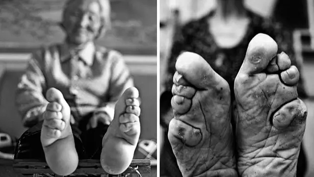 Mengikat kaki/bored panda