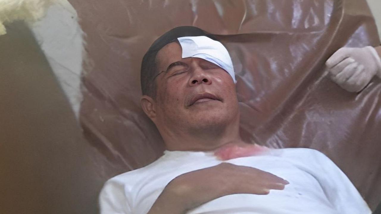 Akibat aksi pelemparan menyebabkan anggota TNI-Polri terluka termasuk Penjabat Gubernur Papua Ridwan Rumasukun.<br>