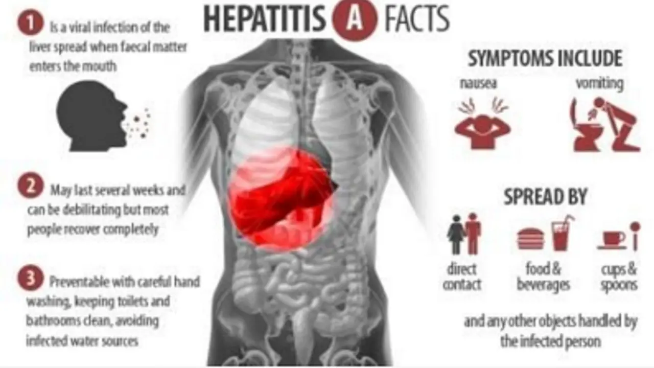 Hepatitis A