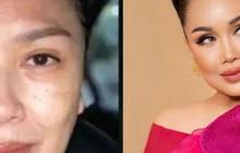 Kembali Muda Bak ABG, 9 Potret Transformasi Artis Indonesia Sebelum & Sesudah Face Lifting