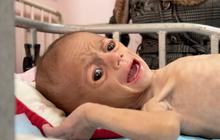 Tangisan Bayi itu Lirih, Namun Menggetarkan Jiwa', Anak-anak Gaza Berjuang Menahan Sakitnya Kelaparan