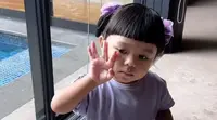 Ameena mengarahkan gaya. [Foto: Instagram/ananghijau]