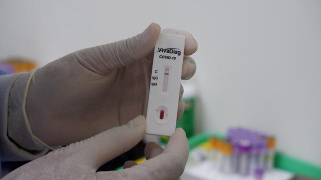 Pemkot Semarang Mulai Gelar Rapid Test Corona