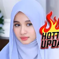 Hottest Update Laudya Cynthia Bella (Instagram/laudyacynthiabella)