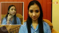 Dianiaya, Luka Memar Bella Luna Belum Hilang