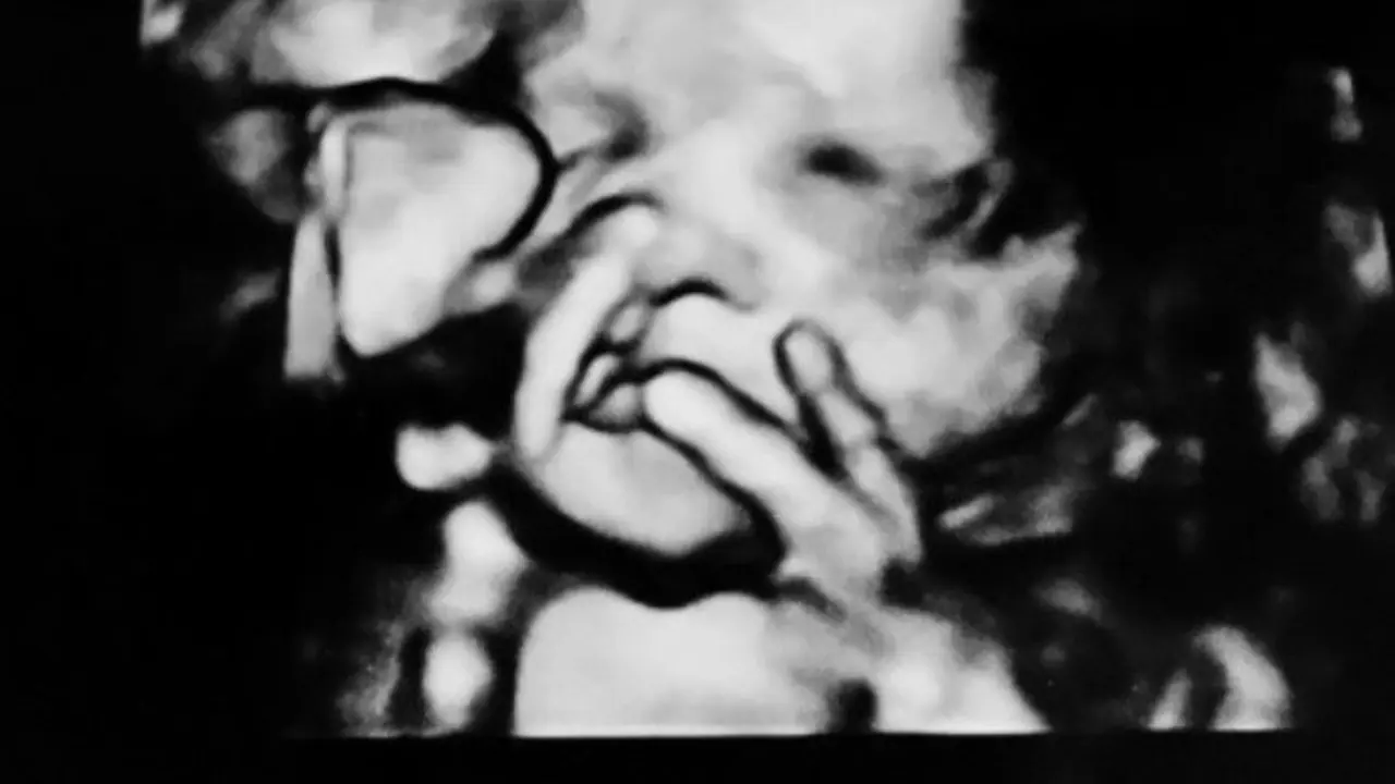 Bayi ini berikan reaksi lucu saat di USG (Picture: SWNS/Metro.co)