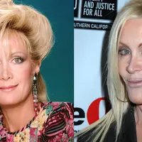 Bukannya tambah cantik, operasi yang gagal bikin wajah 5 selebriti ini terlihat aneh. (Sumber Foto: Purpleclover)