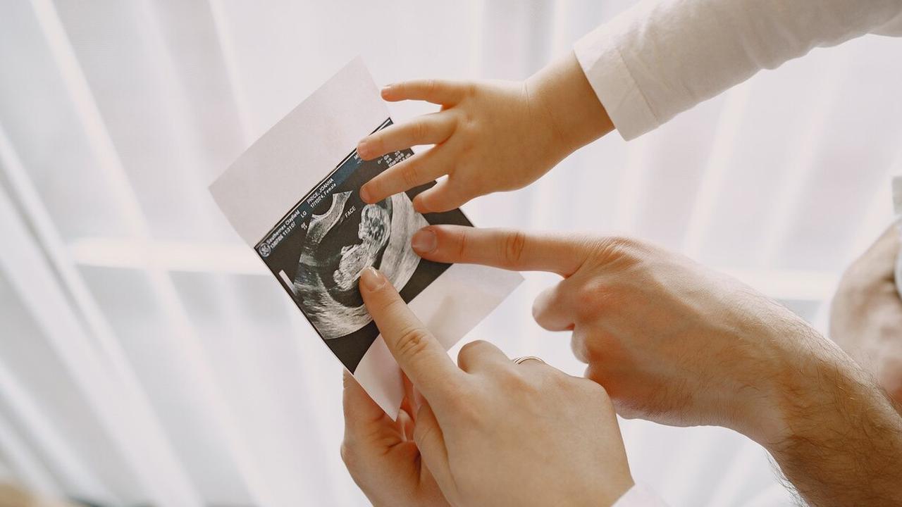 Viral Bayi Dalam Kandungan Wanita ini Tiba-Tiba Hilang saat Mau Lahiran Padahal Rutin USG, Dokter Sampai Bingung