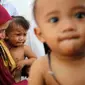 Anak balita menangis ketika akan ditimbang, diukur tinggi badan di Puskesmas, Pandeglang (14/9). Tidak hanya penduduk Asmat di Papua, penduduk Kaduhejo, Pandeglang, sekitar 80 km dari Ibukota Jakarta, juga terindikasi masalah malnutrisi. (Foto:Istimewa)