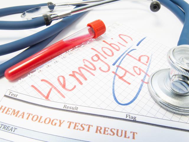 Penyebab Hb Rendah Dan Faktor Risikonya Yang Tak Boleh Disepelekan Hot Liputan6 Com