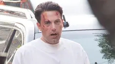 Aktor Hollywood, Ben Affleck tampak babak belur saat berjalan di jalanan kota Los Angeles. Aktor 43 tahun ini mengenakan pakaian pasien rumah sakit dan menjadi sorotan warga sekitar. (Dailymail.co.uk)