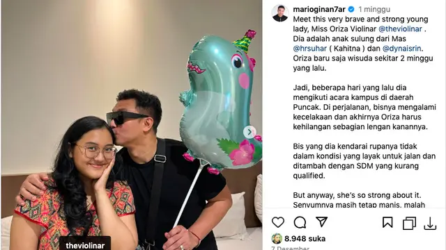 Putri Sulung Pemain Perkusi Kahitna Alami Kecelakaan Hingga Tangan Harus Diamputasi, Ketegarannya Bikin Warganet Kagum. (instagram.com/marioginan7ar)