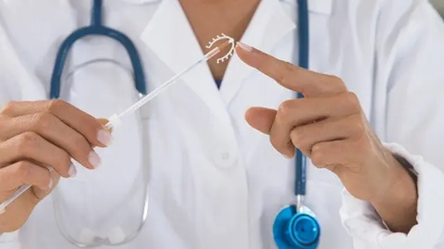 IUD Copper T & Keputihan