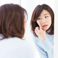 Ilustrasi Cystic acne/copyright shutterstock