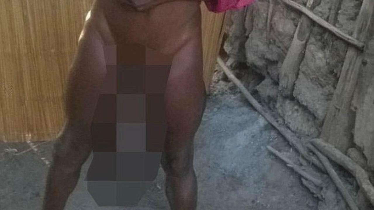 Sorence Owiti Opiyo memiliki penis 10 kali lebih besar dari ukuran rata-rata