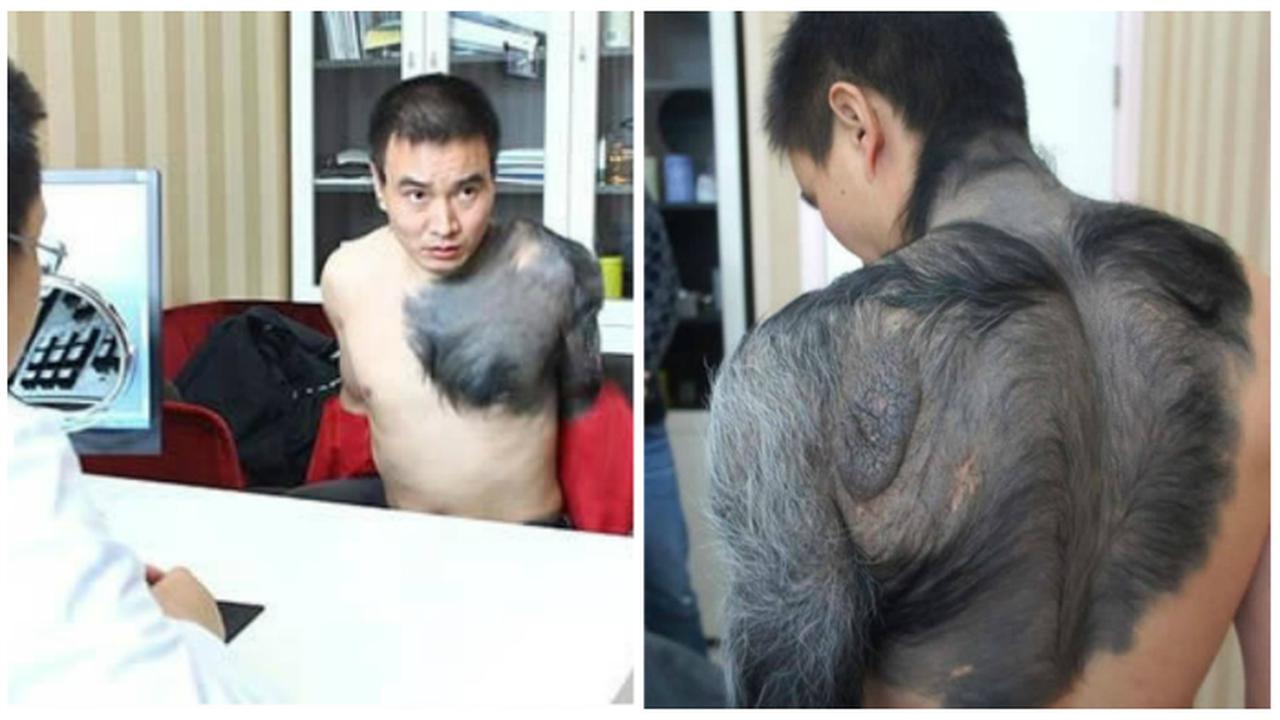 7 Tanda Lahir Paling Aneh dan Unik di Dunia