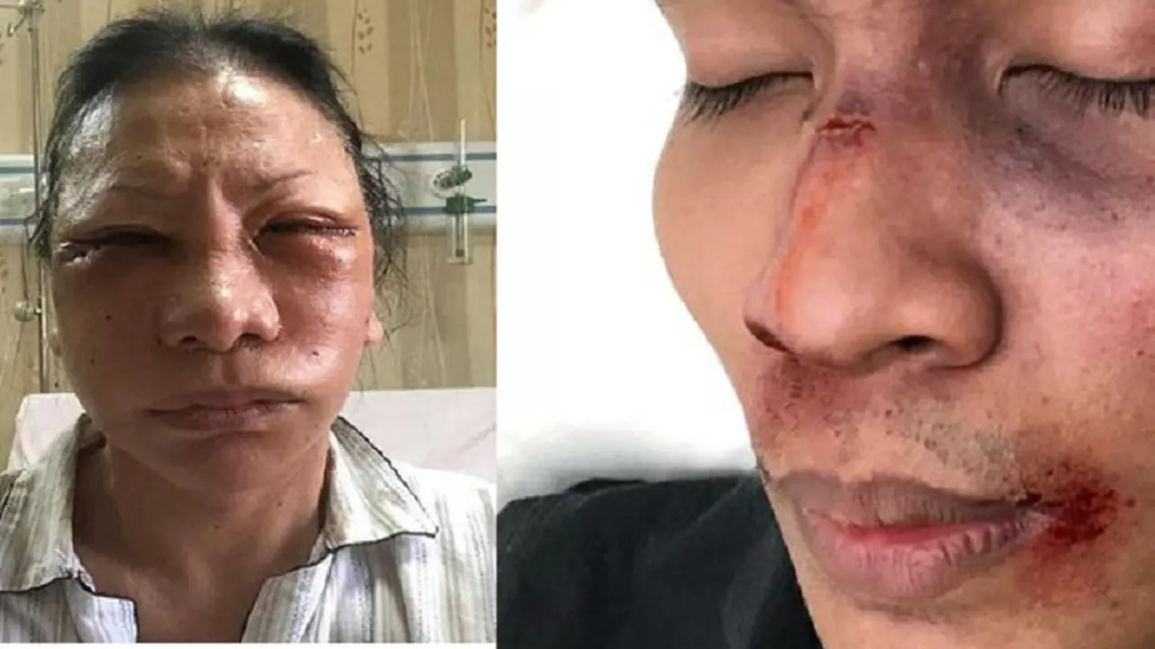Ratna Sarumpaet dan Young Lex