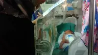Tim dokter terus mengawasi secara intensif satu dari empat bayi kembar LOVE yang dilahirkan di Rumah Sakit dr Soetomo, Surabaya. (Liputan6.com/Dhimas Prasaja)