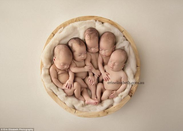 Bayi-bayi yang sangat sehat dan menggemaskan | Photo: Copyright dailymail.co.uk