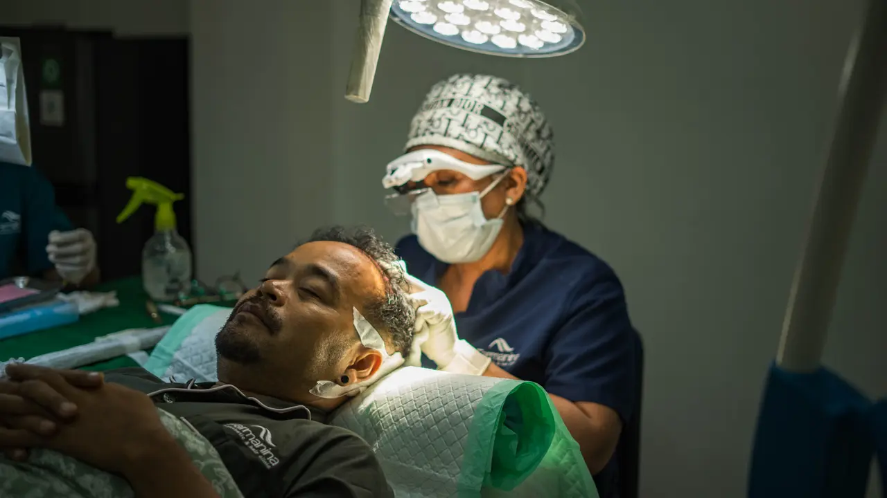 Transplantasi Rambut di Indonesia