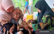 Waspada! Kasus Campak Pamekasan Renggut 12 Nyawa, Dinkes Tetapkan KLB di 18 Desa