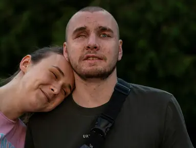 Vlada Ryabets (kiri) bersandar pada tunangannya Ivan Soroka, seorang mantan tentara Ukraina berusia 27 tahun yang buta akibat perang di sebuah pusat rehabilitasi untuk tentara yang kehilangan penglihatan mereka di medan perang dekat Rivne, Ukraina, 20 Juli 2023. (AP Photo/Jae C. Hong)