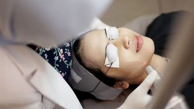 Laser Photorejuvenation