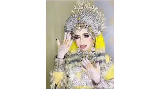 Masih Ingat Nurrani yang Ngaku 'Istri' Iqbaal Ramadhan? Kini Sah Jadi Istri Orang