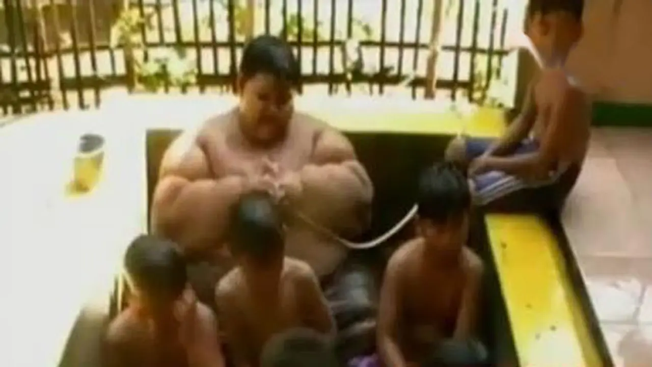 Arya Bocah Obesitas