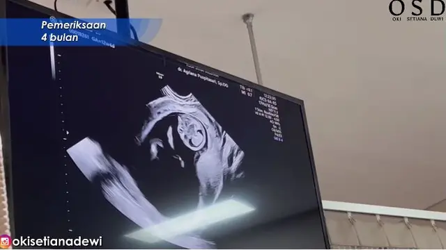 6 Momen Ria Ricis Cek Kandungan, Wajah Bayinya Bikin Penasaran
