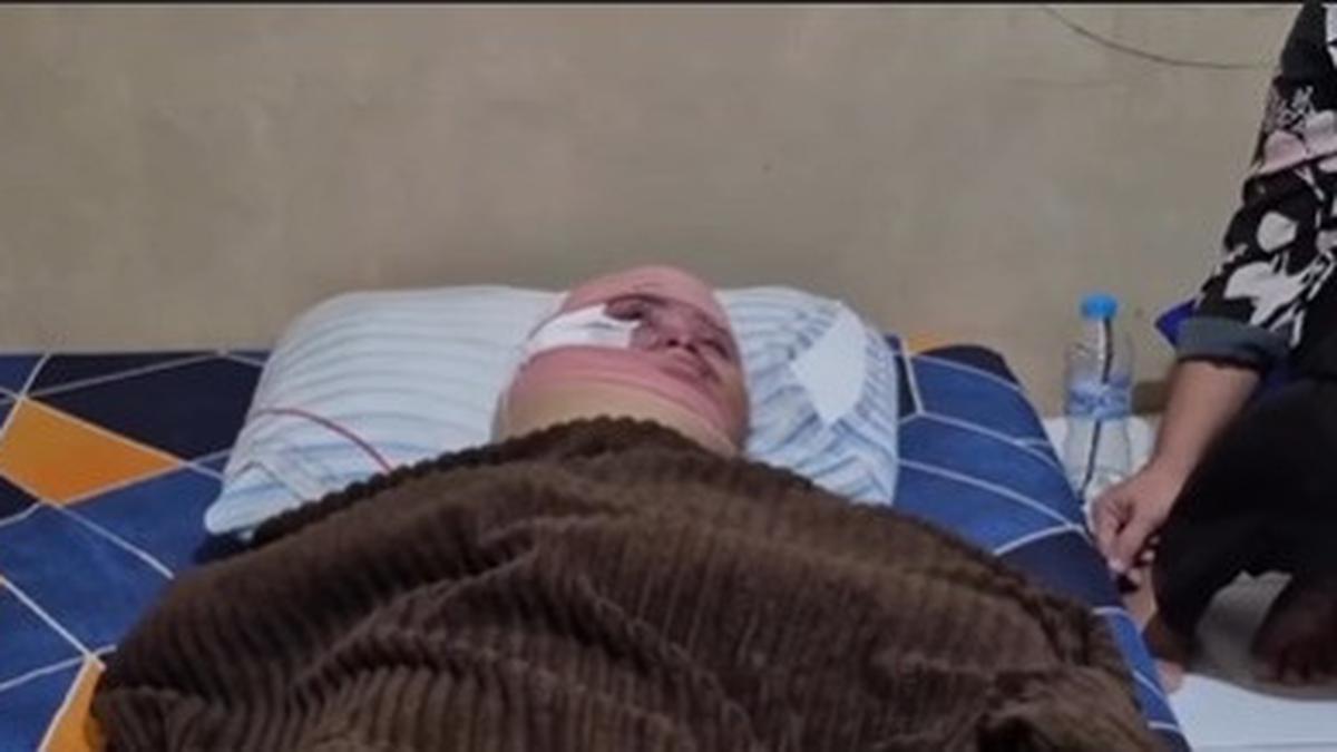 Ibu Korban Penyiraman Air Keras Murka karena Penahanan Pelaku Ditangguhkan, Begini Jawaban Polisi