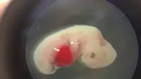 Untuk pertama kalinya, para ilmuwan berhasil membuat bagian dari tubuh manusia dari embrio babi.