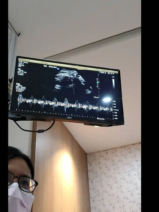 Bebi Silvana (Instagram/bebi.silvana)