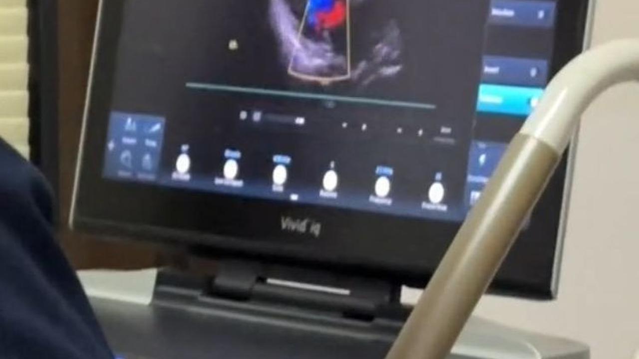 Setelah itu, jemaah langsung dibawa ke ruang rawat inap dan dilakukan pemeriksaan lanjutan oleh dokter spesialis jantung.