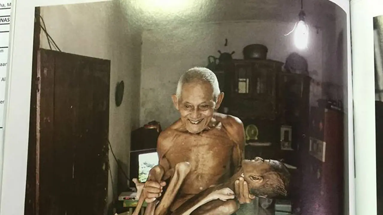 Anak Gizi Buruk di Jabar, Netizen Ramai-ramai Lapor Gubernur Aher