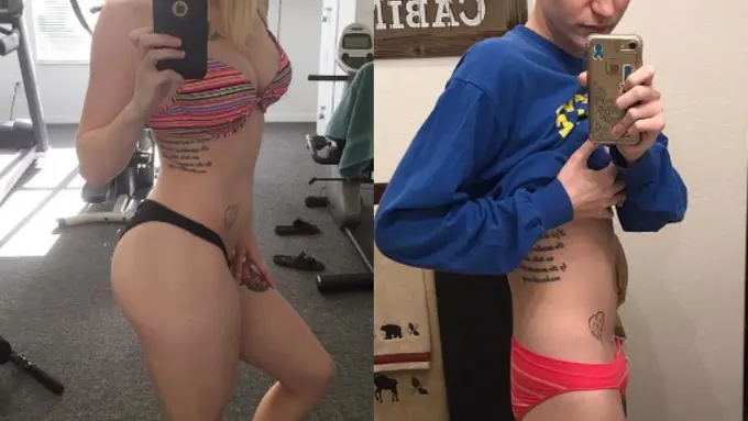 Kanker Hanya Mengubah Fisikku, Bukan Keyakinanku