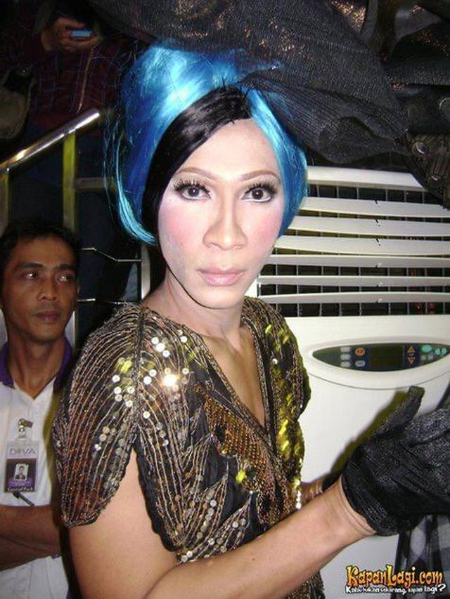 Sering Tampil Nyentrik, Ini 6 Potret Transformasi Aming