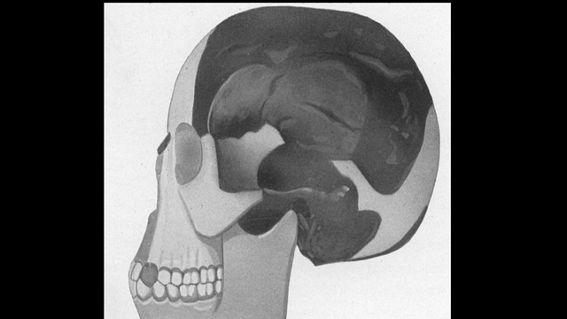 18-12-1912: Klaim Penemuan Fosil Setengah Manusia-Kera
