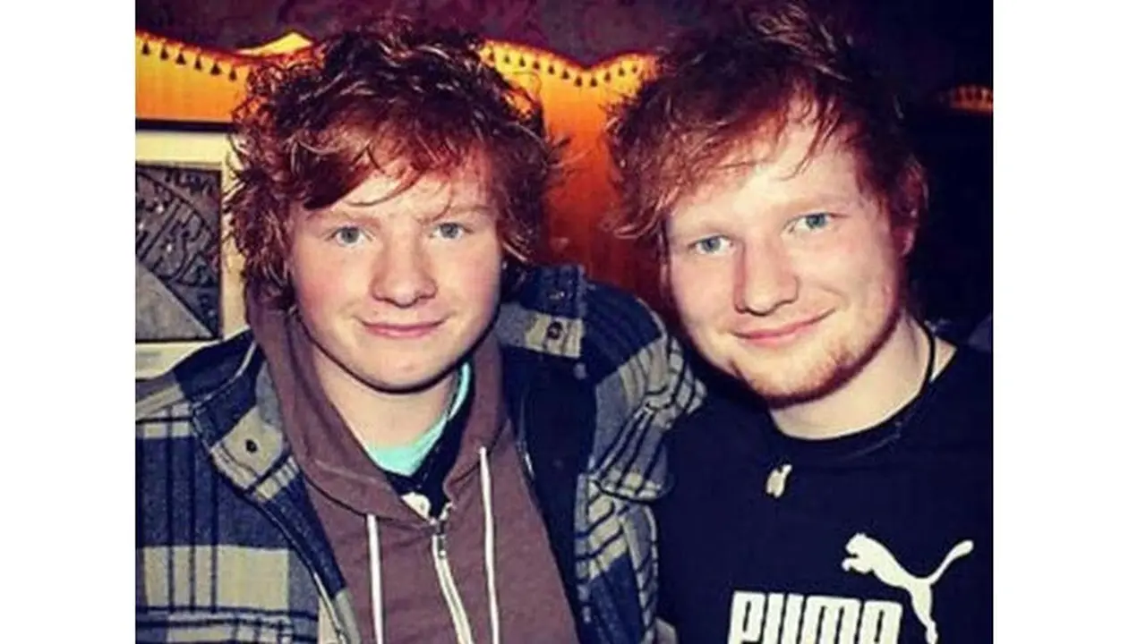 Mirip Ed Sheeran, Buat Pria Ini Terkenal Namun Juga Sulit Dapat Pacar