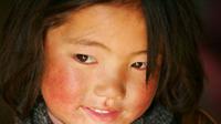 Seorang anak yang memiliki pipi kemerahan karena tinggal di pegunungan tibet (Sumber foto: Presscluboftibet.org)