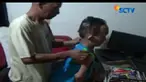 Mengidap penyakit fibrodysplasia ossificans progressive, tubuh pemuda 18 tahun ini kaku hingga tidak bisa digerakan.